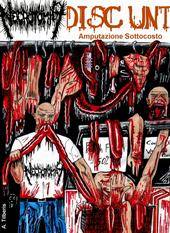 Amputazione Sottocosto